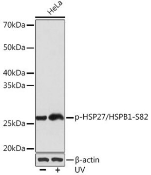 Anti-Phospho-HSP27/HSPB1-S82 antibody produced in rabbit