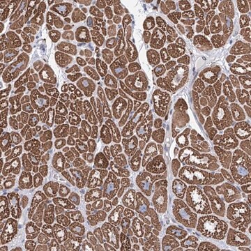 Anti-LCLAT1 antibody produced in rabbit Prestige Antibodies&#174; Powered by Atlas Antibodies, affinity isolated antibody, buffered aqueous glycerol solution