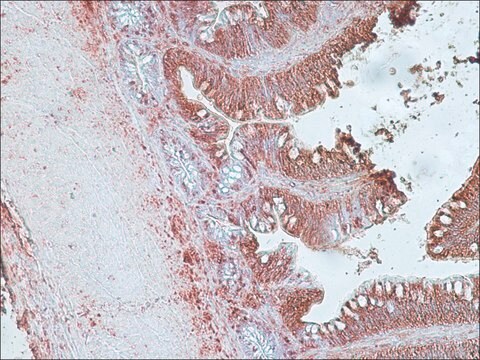 Anti-Corticotropin Releasing Factor antibody produced in rabbit IgG fraction of antiserum, buffered aqueous solution