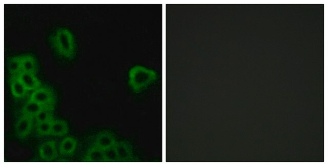 Anti-PE2R4 antibody produced in rabbit affinity isolated antibody