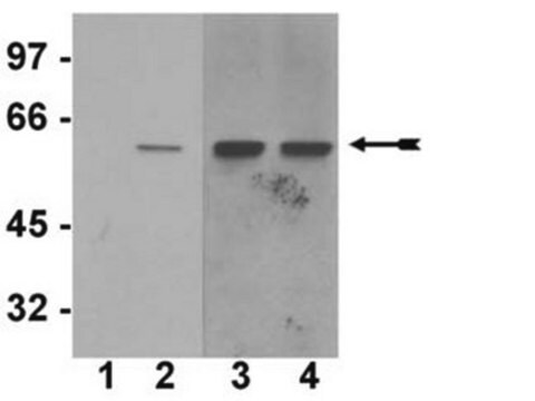 Anti-phospho-Akt1/PKB&#945; (Ser473) Antibody, clone SK703, rabbit monoclonal culture supernatant, clone SK703, Upstate&#174;