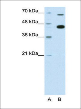 Anti-ZBTB33 antibody produced in rabbit affinity isolated antibody