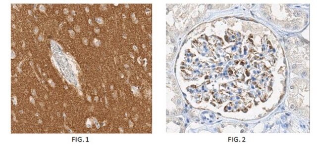 Anti-alpha-Synuclein (aa 121-125) Antibody, clone Syn211 (Ascites Free) clone Syn211, from mouse