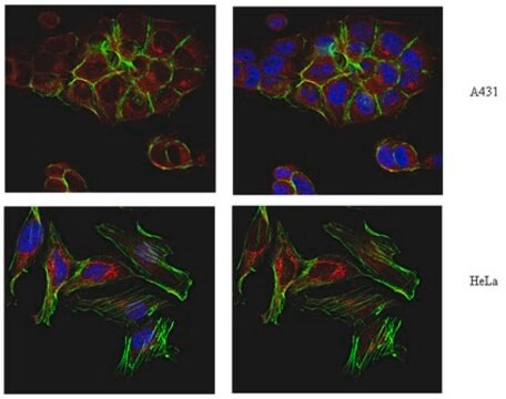 Anti-TGN46, Antibody from rabbit, purified by affinity chromatography