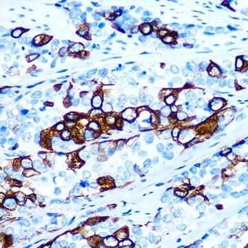 Przeciwciało przeciw cytokeratynie 5 (KRT5), klon 3P3T9, królicze monoklonalne