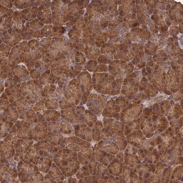 Anti-SNX33 antibody produced in rabbit Prestige Antibodies&#174; Powered by Atlas Antibodies, affinity isolated antibody, buffered aqueous glycerol solution