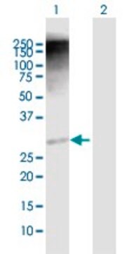 Anti-RAD1 antibody produced in rabbit purified immunoglobulin, buffered aqueous solution