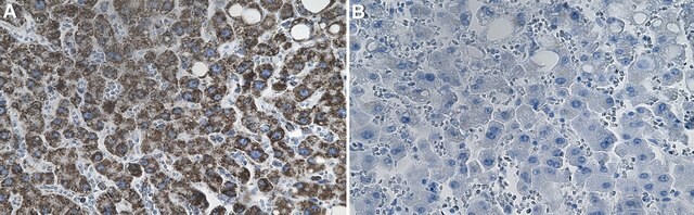 Anti-ATP Synthase &#946; Antibody, clone 1E6 ZooMAb&#174; Rabbit Monoclonal recombinant, expressed in HEK 293 cells