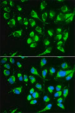 Anty-SLC22A5 affinity isolated antibody