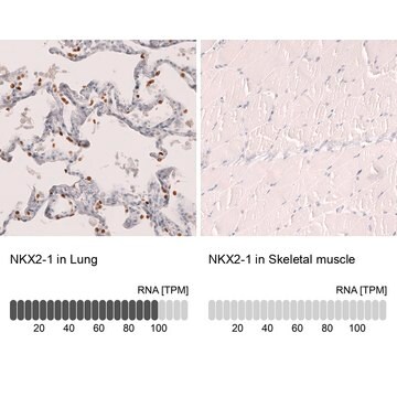 Monoclonal Anti-Nkx2-1 Antibody Produced In Mouse Prestige Antibodies&#174; Powered by Atlas Antibodies, clone CL14531, affinity isolated antibody, buffered aqueous glycerol solution