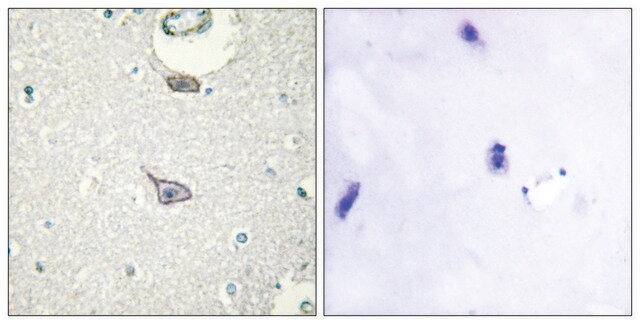 Anti-CADM4 antibody produced in rabbit affinity isolated antibody