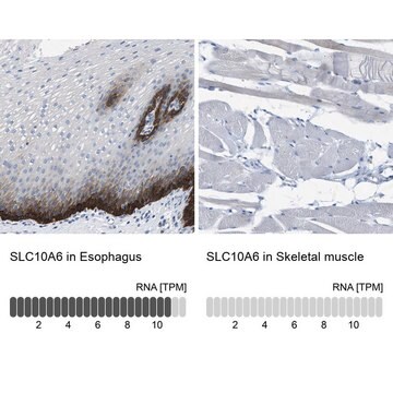 Anti-SLC10A6 antibody produced in rabbit Prestige Antibodies&#174; Powered by Atlas Antibodies, affinity isolated antibody, buffered aqueous glycerol solution