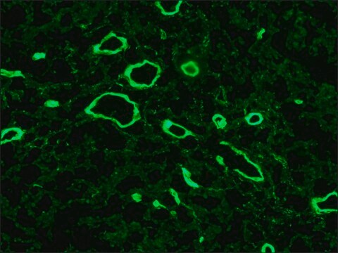 モノクローナル抗-コラーゲン、タイプVII マウス宿主抗体 clone LH7.2, ascites fluid