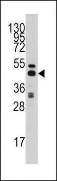 ANTI-S ADENOSYLHOMOCYSTEINE HYDROLASE (ACHY)(C-TERMINAL) antibody produced in rabbit purified immunoglobulin, buffered aqueous solution