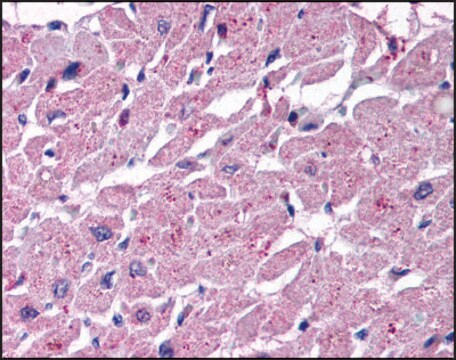 Anti-CYSLT2 (AB1) antibody produced in rabbit affinity isolated antibody, buffered aqueous solution