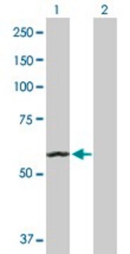 抗ACO2抗体 ウサギ宿主抗体 purified immunoglobulin, buffered aqueous solution