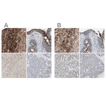 抗ALPL ウサギ宿主抗体 Ab2, Prestige Antibodies&#174; Powered by Atlas Antibodies, affinity isolated antibody, buffered aqueous glycerol solution