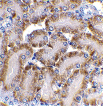 Anti-CAD antibody produced in rabbit affinity isolated antibody