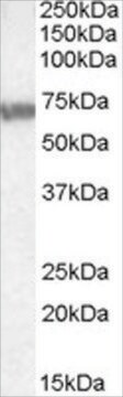 Anti-ABCD4 antibody produced in goat affinity isolated antibody, buffered aqueous solution