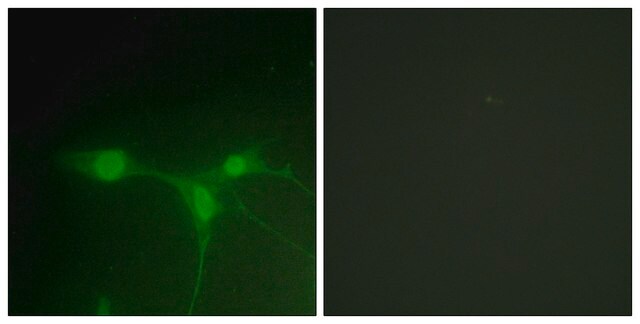 Anti-Breast Tumor Kinase antibody produced in rabbit affinity isolated antibody