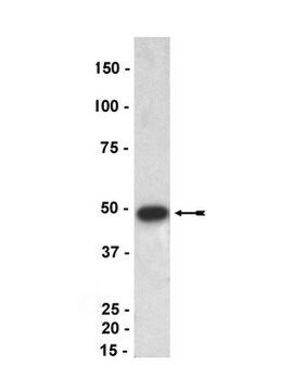 Anti-p47-phox (mouse) Antibody Upstate&#174;, from rabbit