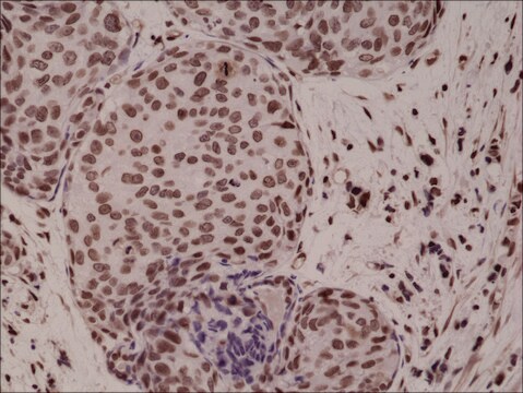 Anti-p38 MAPK Phospho (pT180/pY182) antibody, Rabbit monoclonal recombinant, expressed in HEK 293 cells, clone RM243, purified immunoglobulin