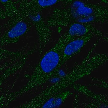 Anti-EPG5 antibody produced in rabbit Prestige Antibodies&#174; Powered by Atlas Antibodies, affinity isolated antibody, buffered aqueous glycerol solution