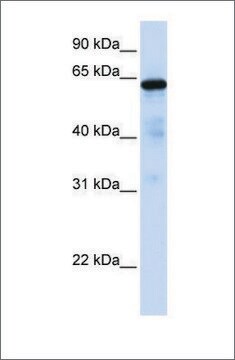 Anti-FOXN4 antibody produced in rabbit affinity isolated antibody