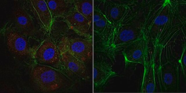 Anti-phospho-VE-Cadherin (Tyr685) Antibody, Alexa Fluor&#8482; 555 Conjugate from rabbit, ALEXA FLUOR&#8482; 555