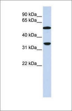 抗-C4B 兔抗 affinity isolated antibody