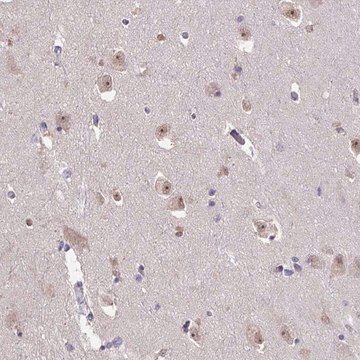 Anti-SENP3 antibody produced in rabbit Prestige Antibodies&#174; Powered by Atlas Antibodies, affinity isolated antibody, buffered aqueous glycerol solution