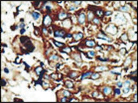 Anti-PACSIN2 (C-term) antibody produced in rabbit IgG fraction of antiserum, buffered aqueous solution