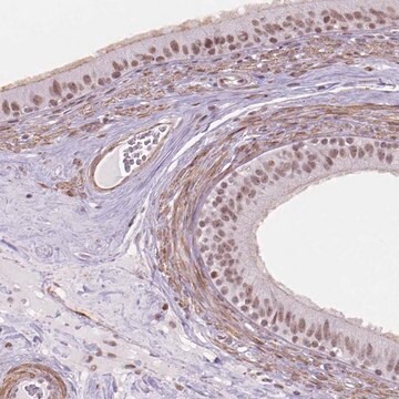 Anti-HOXD4 antibody produced in rabbit Prestige Antibodies&#174; Powered by Atlas Antibodies, affinity isolated antibody, buffered aqueous glycerol solution