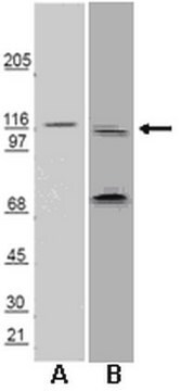 Anti-Huntingtin-Interacting Protein 1 Related (HIP1R)-Antikörper Chemicon&#174;, from rabbit