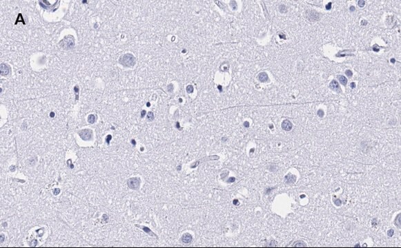 抗-MBP抗体，克隆2N6，ZooMAb&#174;兔单克隆抗体 recombinant, expressed in HEK 293 cells