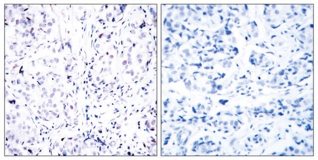 Anti-Retinoblastoma, C-Terminal antibody produced in rabbit affinity isolated antibody