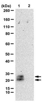 Anti-CTGF Antibody, N-Term Antibody from goat, purified by affinity chromatography