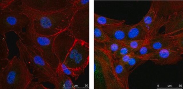 Anti-NR4A1 (Nur77) from rabbit, purified by affinity chromatography