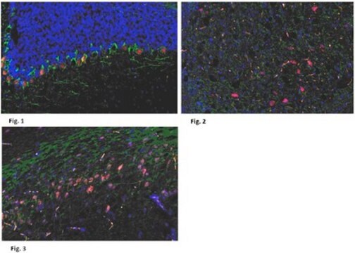 Anti-CELSR1 Antibody from rabbit, purified by affinity chromatography