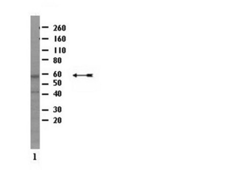 Anti-MBD1 Antibody, CT from rabbit