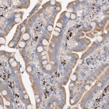 Anti-SLC5A11 antibody produced in rabbit Prestige Antibodies&#174; Powered by Atlas Antibodies, affinity isolated antibody, buffered aqueous glycerol solution