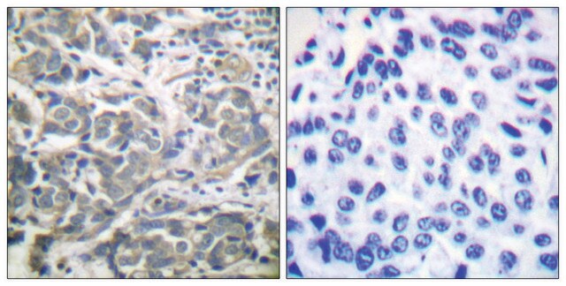 Anti-AMPK &#945; antibody produced in rabbit affinity isolated antibody