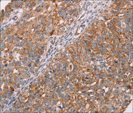 Anti-RMDN3 antibody produced in rabbit affinity isolated antibody