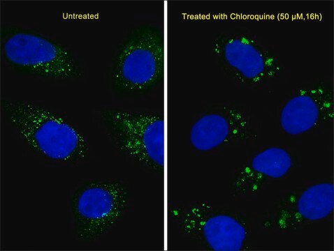 单克隆抗-LC3（APG8） 小鼠抗 clone 166AT1234, IgG fraction of antiserum, buffered aqueous solution