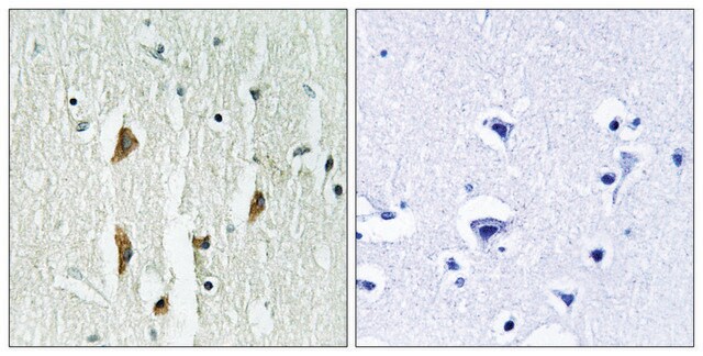 Anti-PAK1 antibody produced in rabbit affinity isolated antibody