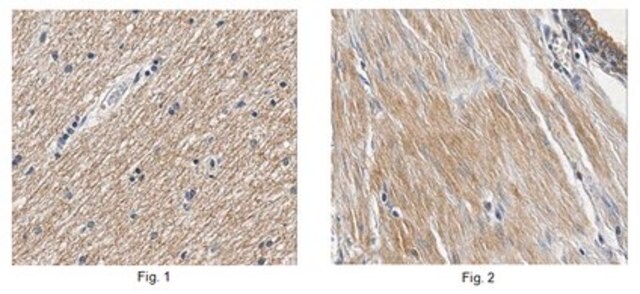 Anticorps anti-TRPM4 from rabbit, purified by affinity chromatography