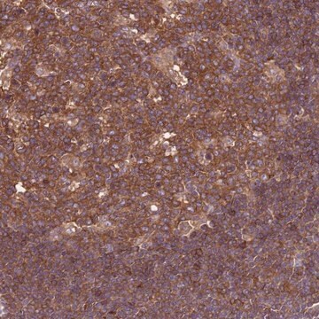 Anti-ATXN2L antibody produced in rabbit Prestige Antibodies&#174; Powered by Atlas Antibodies, affinity isolated antibody, buffered aqueous glycerol solution