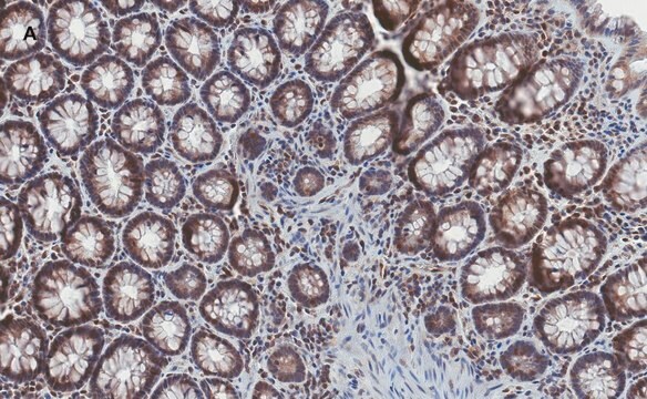 抗Stat3抗体 クローン4N11 ZooMAb&#174;ウサギモノクローナル recombinant, expressed in HEK 293 cells