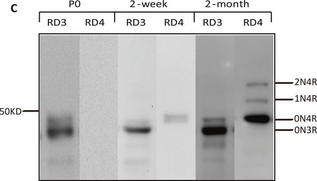 Anti-Tau-Antikörper (4-repeat Isoform, RD4), Klon 1E1/A6 culture supernatant, clone 1E1/A6, Upstate&#174;