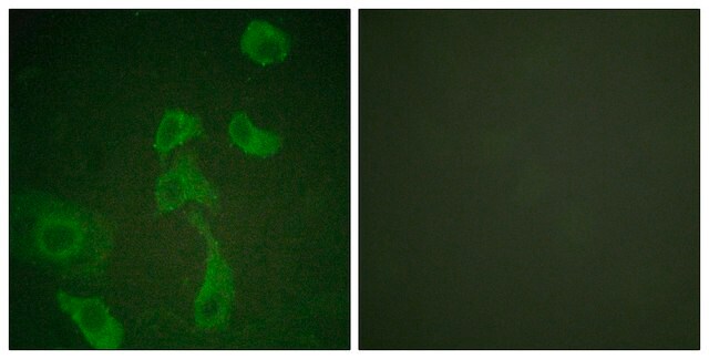 Anti-IL-2R &#946; antibody produced in rabbit affinity isolated antibody